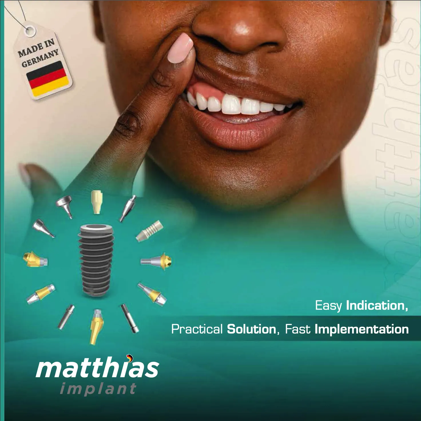 Matthias Catalog